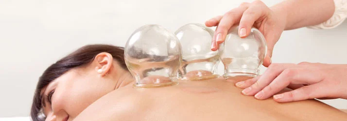 Chiropractic Loveland OH Cupping